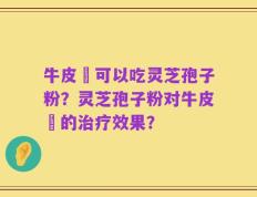 牛皮癬可以吃灵芝孢子粉？灵芝孢子粉对牛皮癬的治疗效果？
