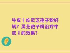 牛皮癬吃灵芝孢子粉好转？灵芝孢子粉治疗牛皮癬的效果？