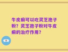 牛皮癣可以吃灵芝孢子粉？灵芝孢子粉对牛皮癣的治疗作用？