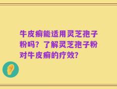 牛皮癣能适用灵芝孢子粉吗？了解灵芝孢子粉对牛皮癣的疗效？