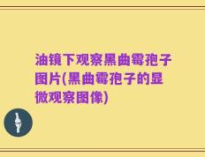 油镜下观察黑曲霉孢子图片(黑曲霉孢子的显微观察图像)