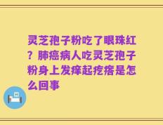 灵芝孢子粉吃了眼珠红？肺癌病人吃灵芝孢子粉身上发痒起疙瘩是怎么回事