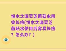 悦木之源灵芝菌菇水用完长痘(悦木之源灵芝菌菇水使用后容易长痘？怎么办？)