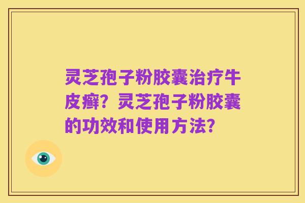 灵芝孢子粉胶囊治疗牛皮癣?灵芝孢子粉胶囊的功效和使用方法?