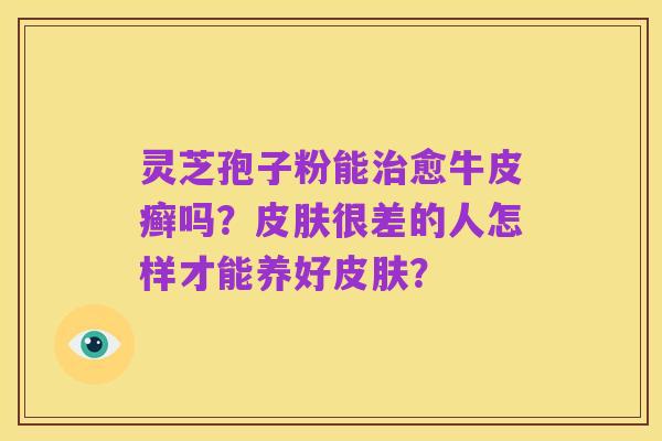 灵芝孢子粉能治愈牛皮癣吗?皮肤很差的人怎样才能养好皮肤?