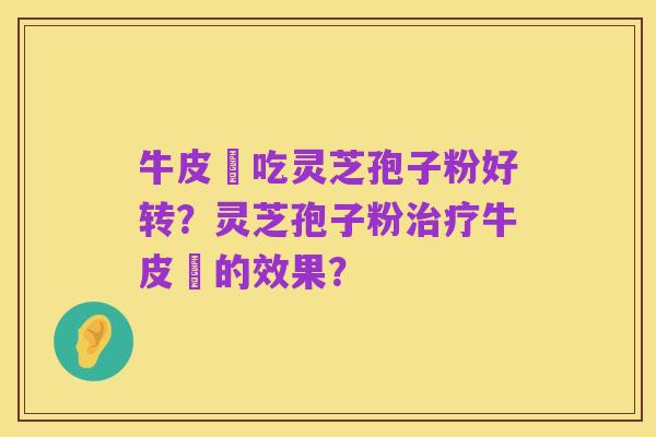 牛皮癬吃灵芝孢子粉好转?灵芝孢子粉治疗牛皮癬的效果?